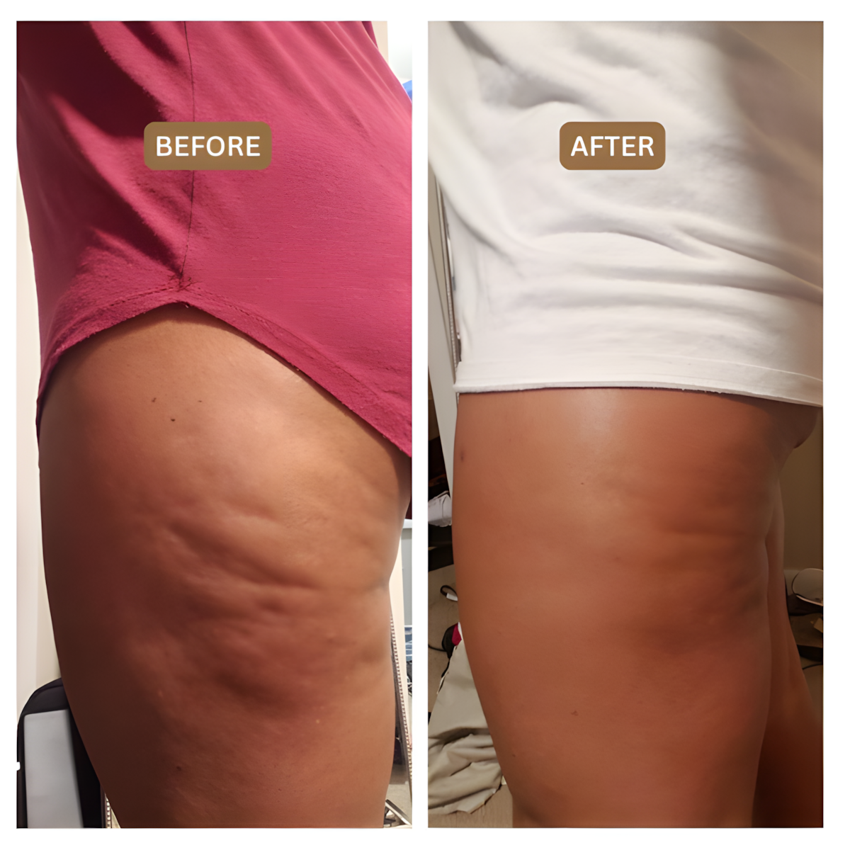 Merova - Anti Cellulite Massage Oil