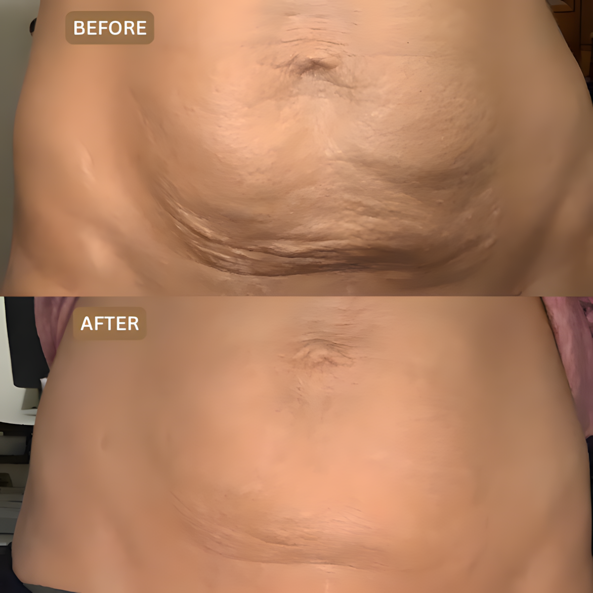 Merova - Anti Cellulite Massage Oil